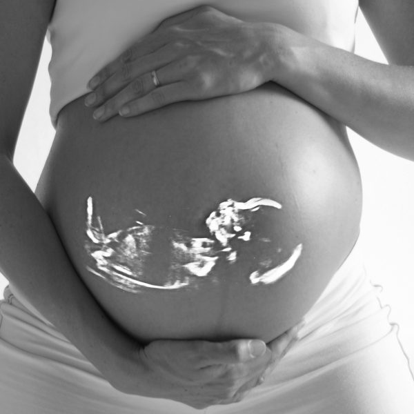 Image of expecting mother for our prenatal packages